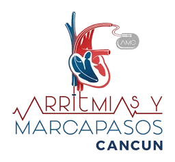 Arritmias y Marcapasos Cancún